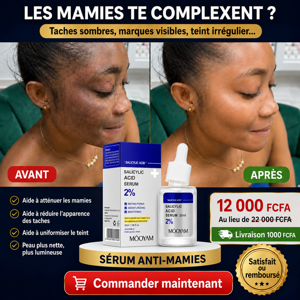 KIT ANTI MAMIES
